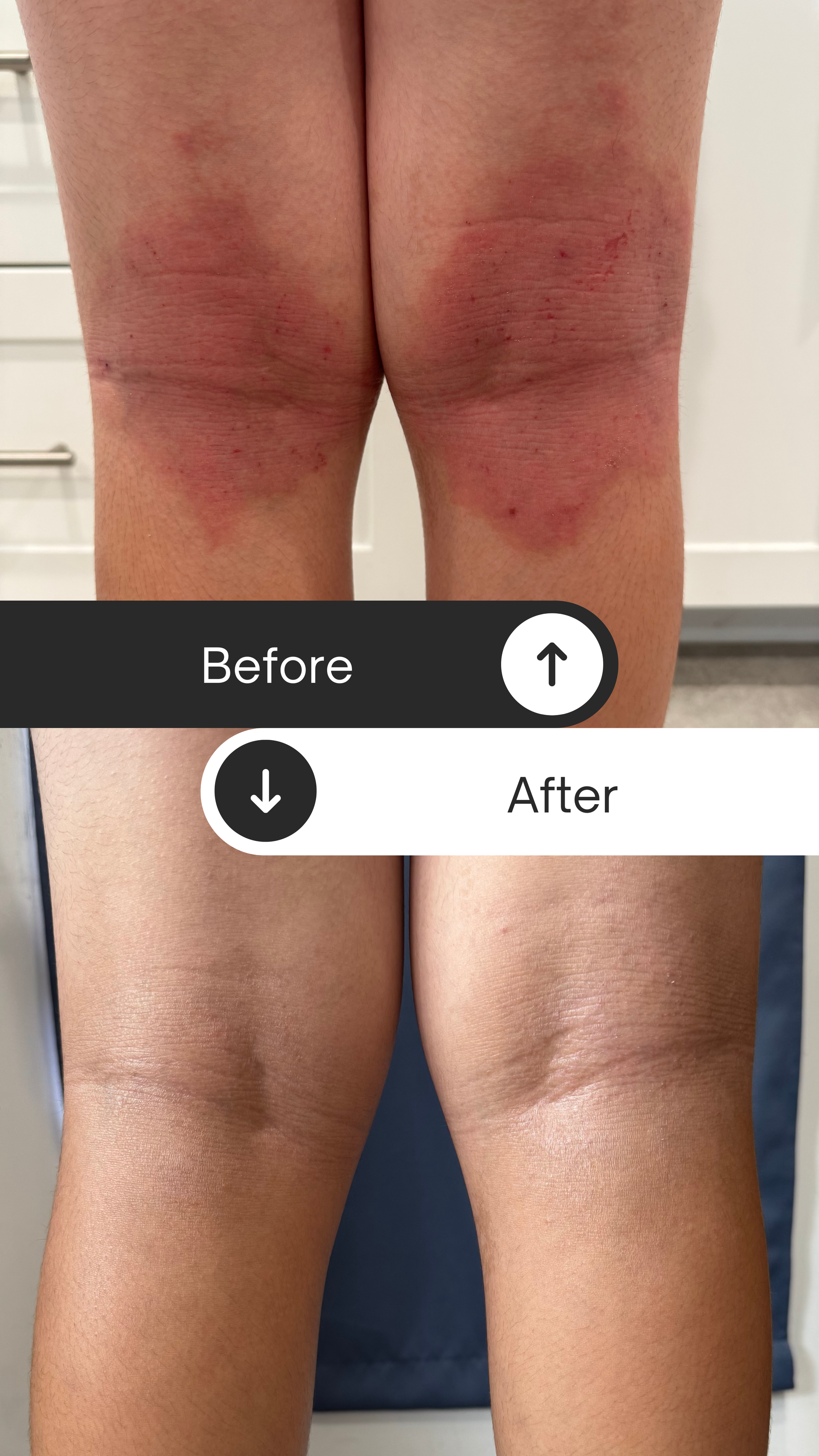 Coastal Calm – Eczema Relief Cream